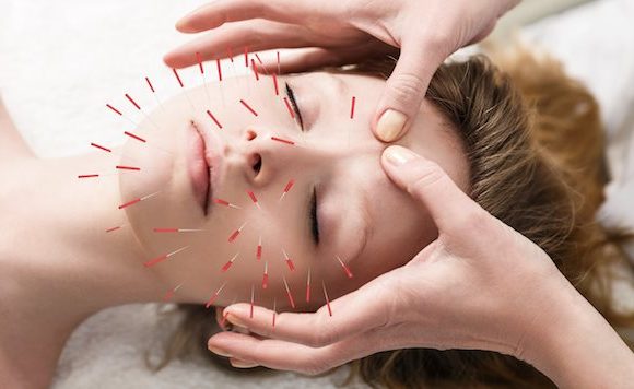 The advantages of Acupressure and Acupuncture