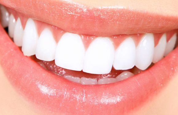 Average Cost Of Teeth Whitening