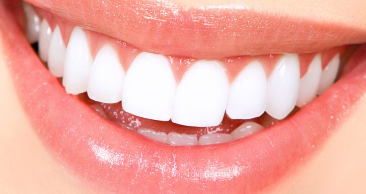Average Cost Of Teeth Whitening