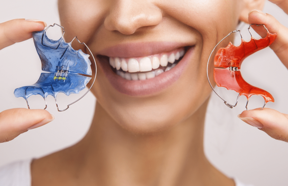 Using Invisible Braces That Enhances your Confidence and Brings back your Smile