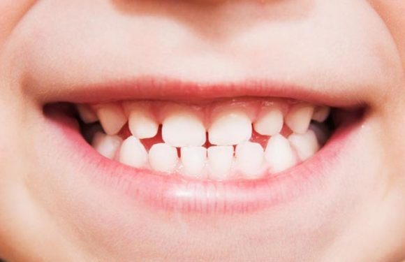 A Handy Guide to Dental Health and Hygiene for Young Kids