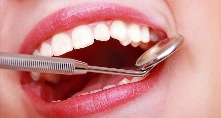 Four Common Dental Issues that Prevent you From Smiling Confidently