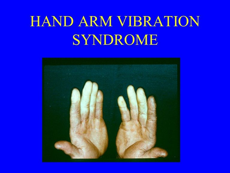 Diagnosis of HandArm Vibration Syndrome (HAVS) My Healthy Prosperity Find your path to health